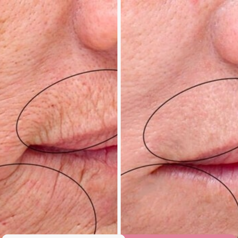 CollaKR™ – Rituel Anti-Âge Intensif au Triple Collagène