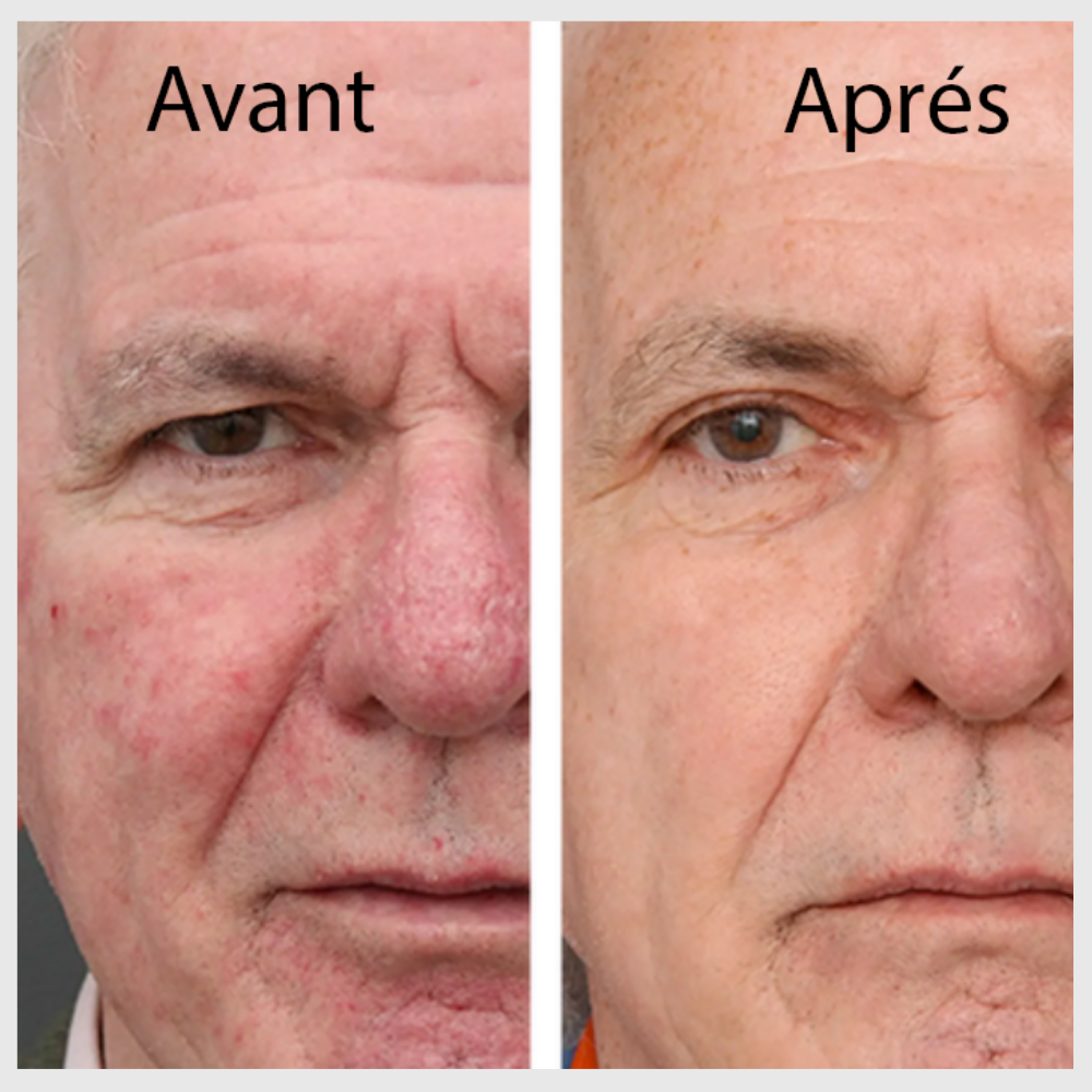 Crème Anti-Rides : Votre Complice Pour Une Peau Douce et Éclatante