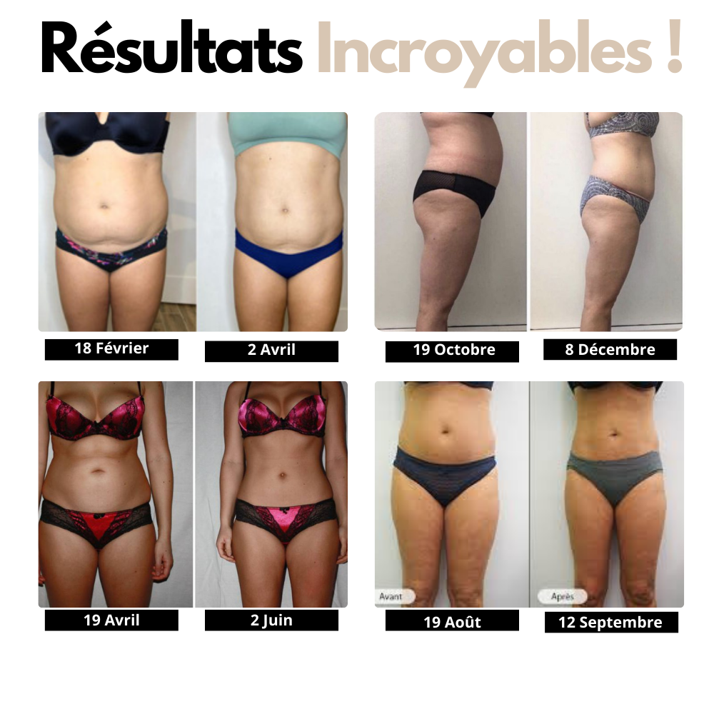 Forméa™ – Tee-Shirt Gainant