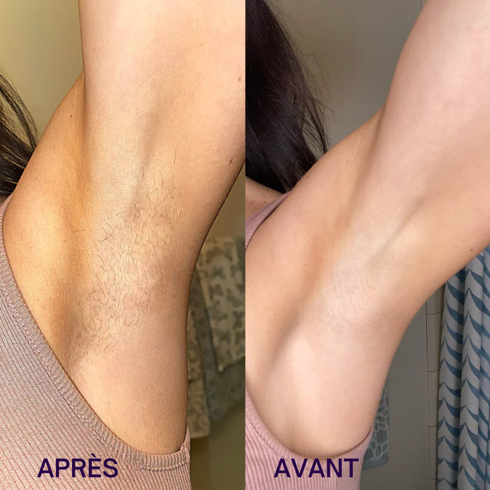 FluideSatin™ – Crème Dépilation Sans Effort