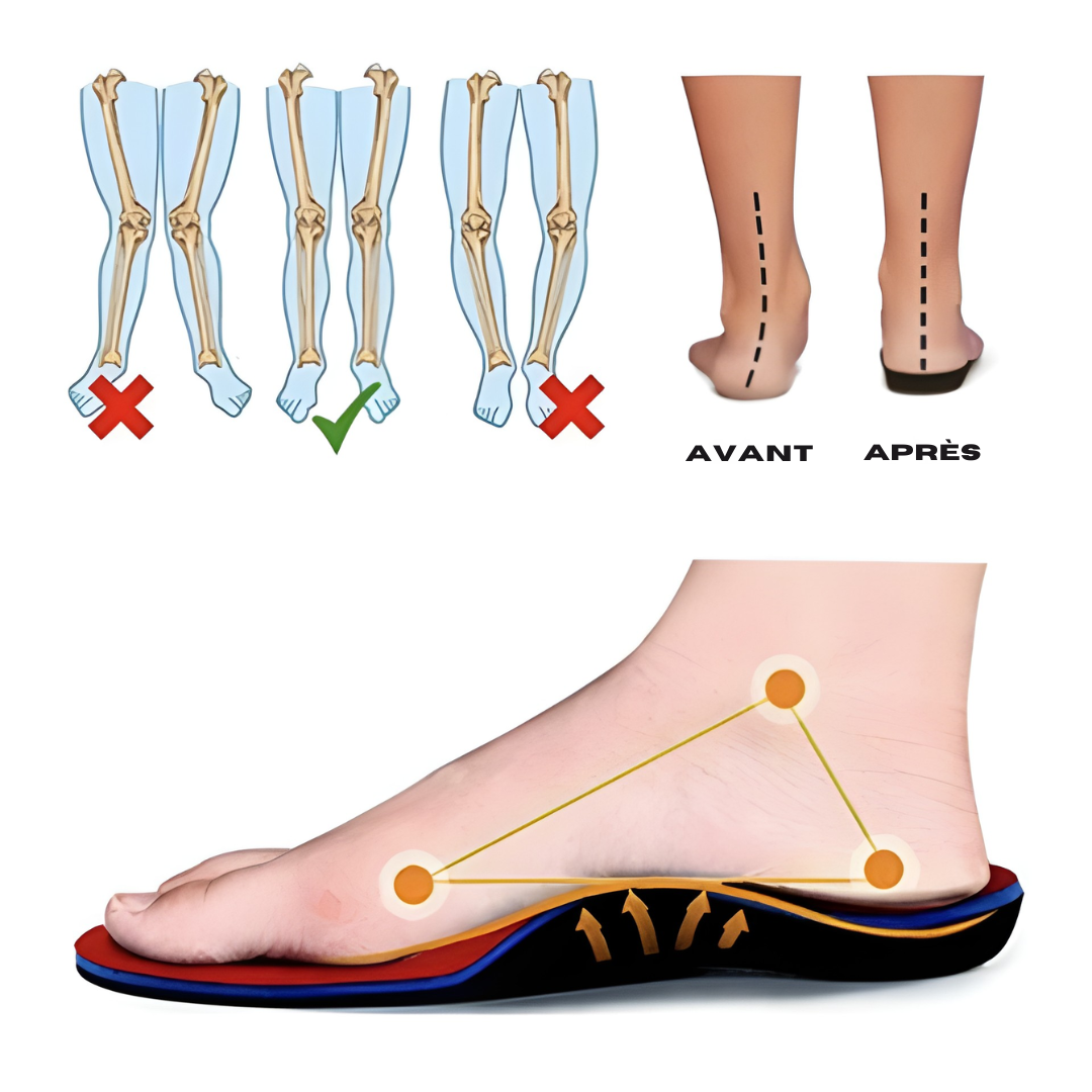 Vellio™ – Baskets Confort Ultra-Légères | Soulagement instantané pour vos pieds